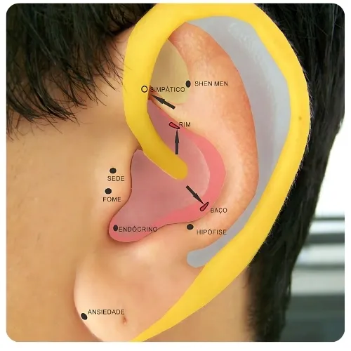 Auriculoterapia para emagrecimento 3 Auriculoterapia para emagrecimento