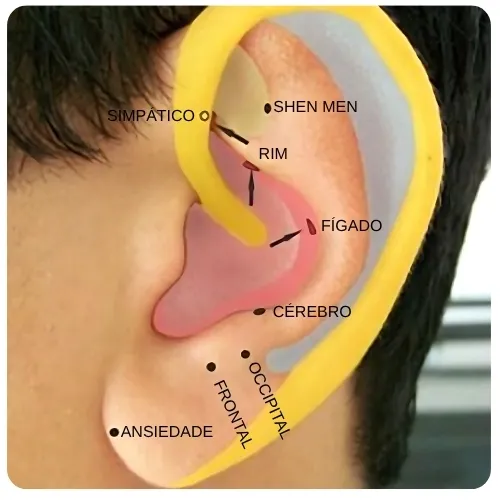 Auriculoterapia para insônia 3 Auriculoterapia para insônia