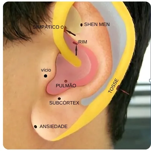 Auriculoterapia para parar de fumar 3 Auriculoterapia para parar de fumar
