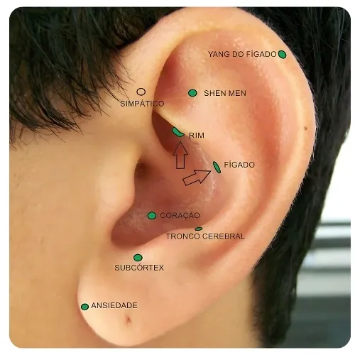 Auriculoterapia para redução do estresse 3 Auriculoterapia para redução do estresse