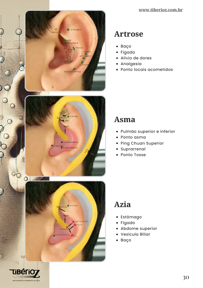 Protocolos de auriculoterapia 10