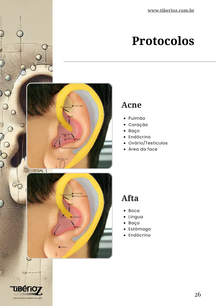Protocolos de auriculoterapia 6