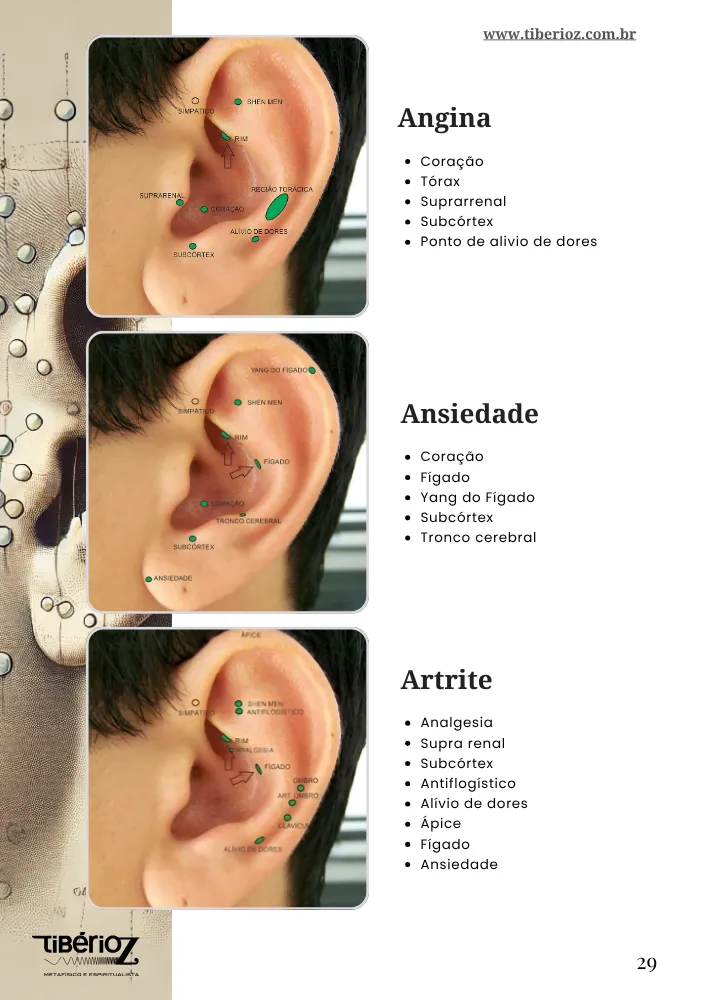 Protocolos de auriculoterapia 9